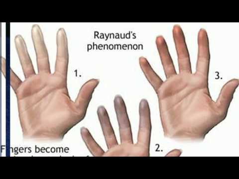how to relieve hand pain