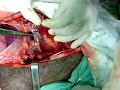 Cirurgia....