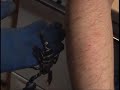 Scorpion sting Halfwitz 2 Scorpion sting Halfwitz 2