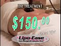lipoease-lose-inches-without-surgery-1800byouthful-30sec.html