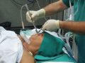 Ventilaci�n e intubaci�n con fastrach