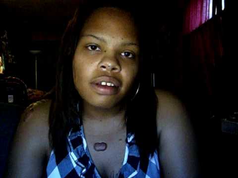 im 24yrsold and ive had keloid skin for about 8yrs, i have been inpsired to 