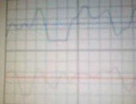 Youtube-videoupotus, klikkaa nähdäksesi!