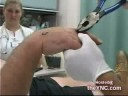 Tirando prego da m�o com alicate...