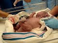 birth c section blood