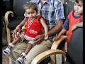 8 limbed baby Lakshmi Tatma 1 year later