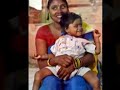 8 limbed baby Lakshmi Tatma 1 year later