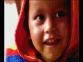 8 limbed baby Lakshmi Tatma 1 year later