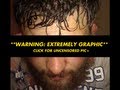 UFC FIGHTER Roy Nelson Face Is Split Open, 20 Stitches Required..