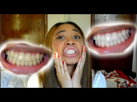 how to whiten your teeth in 5 minutes