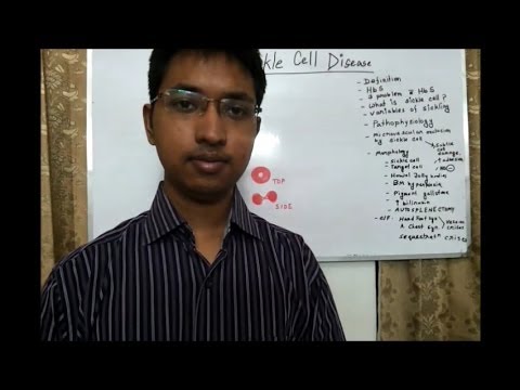 how to treat sickle cell anemia