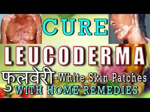 how to cure white spot