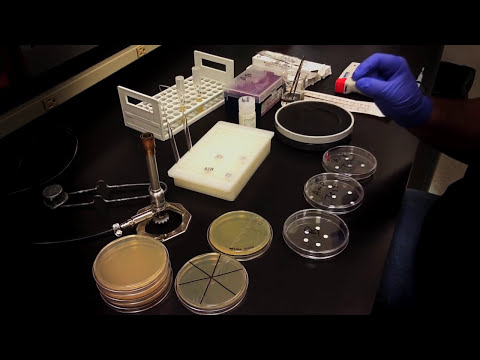 how to measure zone of inhibition bacteria