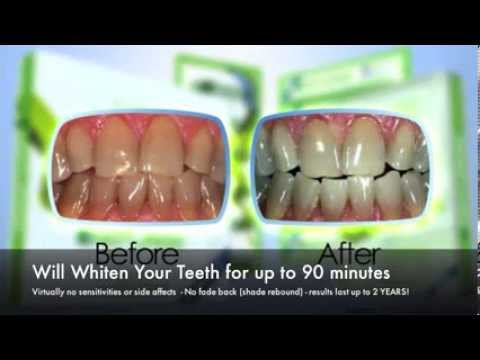 how to whiten teeth naturally australia