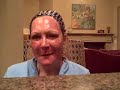 FAT TRANSFER, BLEPHAROPLASTY, PLASMA DIARY IN DALLAS, TEXAS