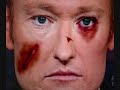 this is a quick vid. on the physical side of domestic violence...our final for english 3...warning contains some graphic images!