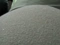 Hiccups Hiccups