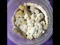 Kidney Stone Symptoms