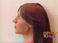 forensic facial reconstruction