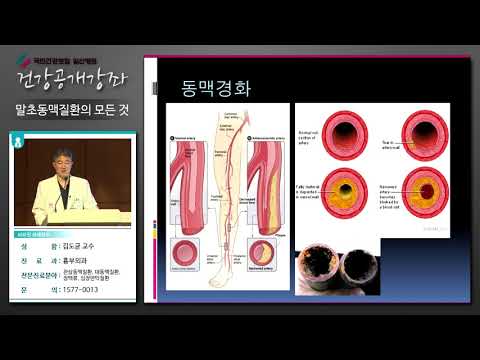 [국민건강보험 일산병원 건강강좌] 말초동맥질환의 모든것