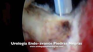 Javier Morales Manzano-7