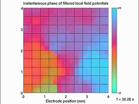 Micro-patterns in the cortex