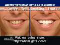 WhiteLight Teeth Whitening - Home Tooth Whitening System - WhiteLightTV.com