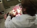 Media Root Canal Demonstration