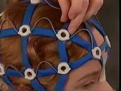 Epilepsy? EEG with HydroDot System: Video 2 – Long Hair