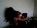 du incendia i capelli alla fede con granuloma settembre 2006 2^H.avi