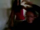 du incendia i capelli alla fede con granuloma settembre 2006 2^H.avi