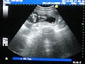 Our baby in the Potter\