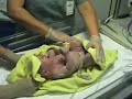 Quentin just born