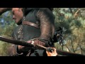 Click here to watch this video SWATH clip - Prince William Attacks