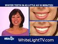 Tooth Whitening at Home Tooth Whitening at Home