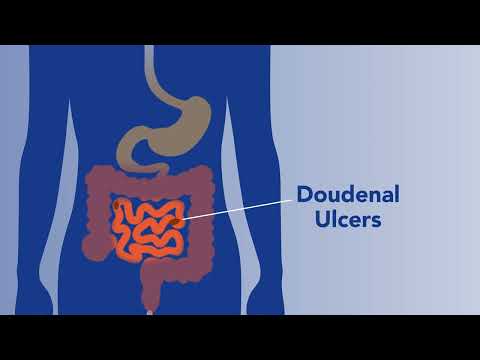 Peptic Ulcer Disease