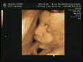 videos de Jude.wmv