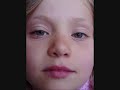 Buteyko Breathing and Asthma