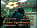 rhinoplasty