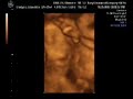 4D ultrasound of our baby girl Estanislao at 25 weeks