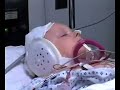 in 2007, documentary filmmakers lisamarie costabile and mark larson followed dr. thomas romo and the little baby face foundation as they treated peyton sherrill, a boy from alabama who was born with microtia; he was born without his right ear.
 
the little baby face foundation is a new york city-based organization of surgeons and medical providers who volunteer their time and expertise to treat children from around the world born with facial birth defects.  dr. thomas romo, a renowned plastic surgeon, started the foundation in 2002.

this is the second half of costabile and larson's 20-documentary.