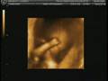 Baby Ultra Sound 4D