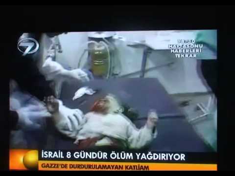 Image de prévisualisation YouTube