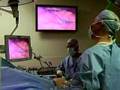 Live Webcast: Laparoscopic Sleeve Gastrectomy (LSG)