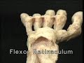 Dalton Carpal Tunnel Syndrome