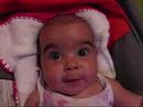 Herm�nia com 3 meses