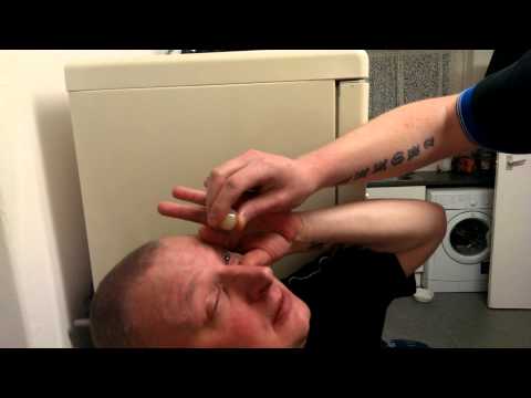 how to relieve onion eyes