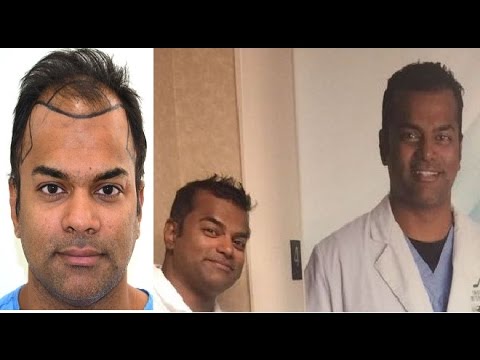 how to hair transplant in india