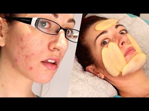 how to treat raw skin