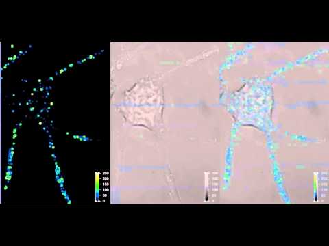 Real time confocal imaging of vesicles trafficking in living neuron